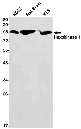 2 - Hexokinase I Rabbit mAb AP75535