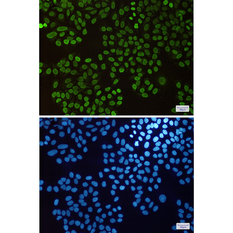 2 - Histone H1.3 Rabbit mAb AP75540
