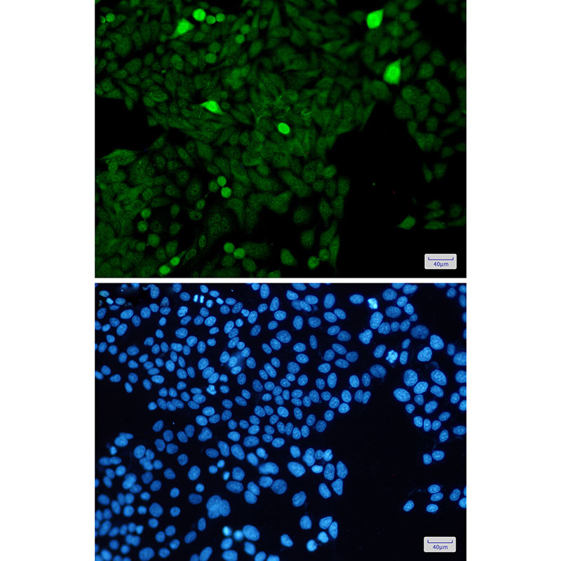 4 - Phospho-Histone H3 (Ser28) Rabbit mAb AP75546
