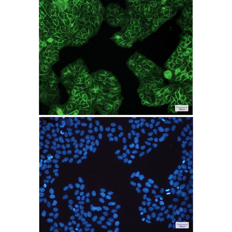 2 - HLA A Rabbit mAb AP75550