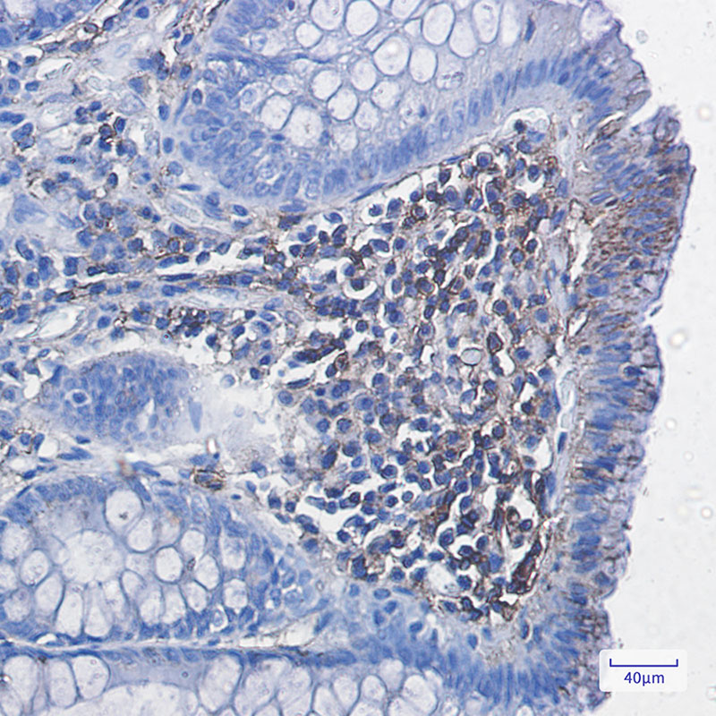8 - HLA A Rabbit mAb AP75550