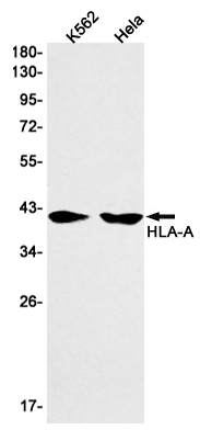 1 - HLA A Rabbit mAb AP75550