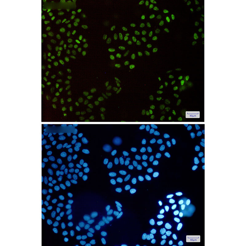 2 - HLTF Rabbit mAb AP75552