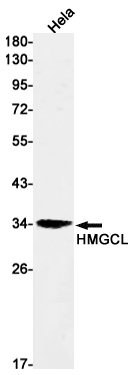 1 - HMGCL Rabbit mAb AP75555