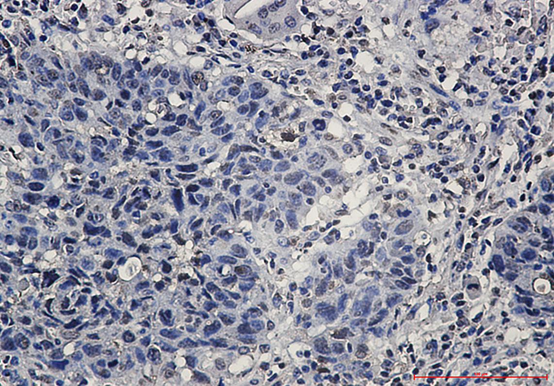 8 - hnRNP K Rabbit mAb AP75563