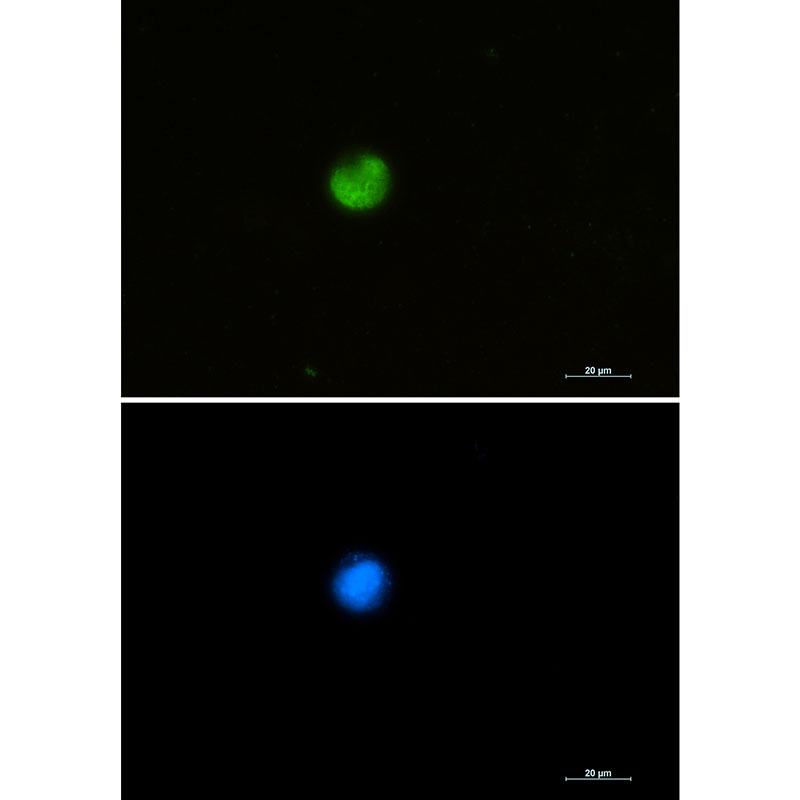1 - hnRNP M Rabbit mAb AP75564