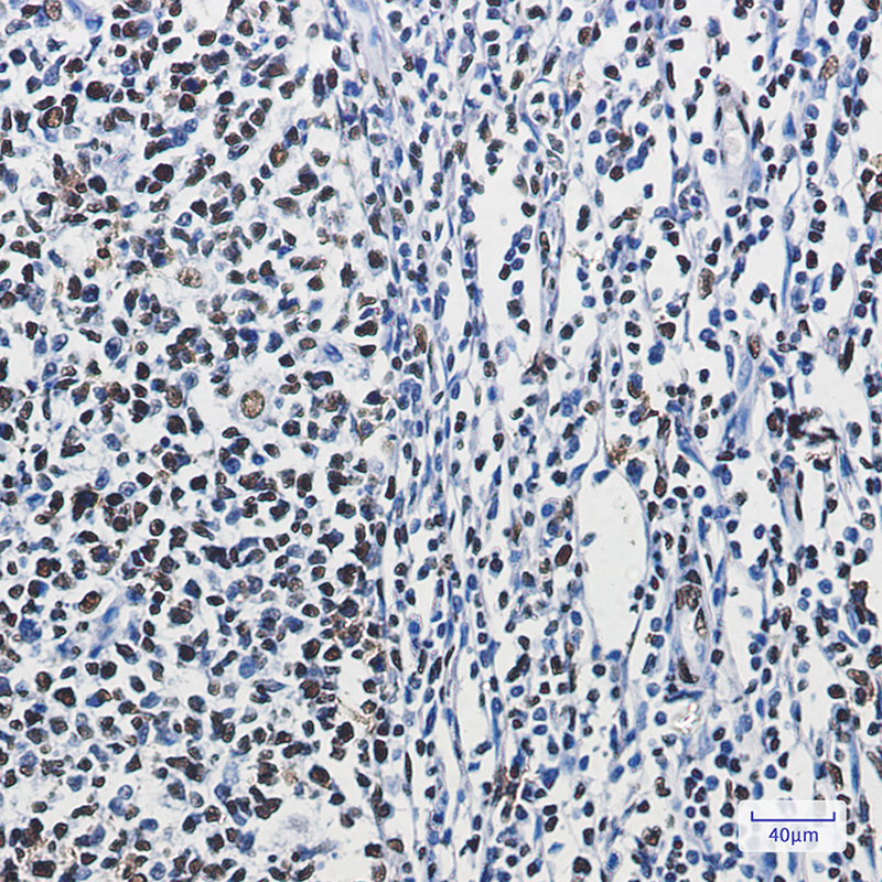 8 - hnRNP M Rabbit mAb AP75564