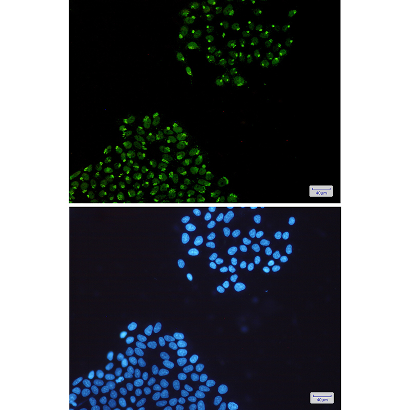 3 - hnRNP Q Rabbit mAb AP75565