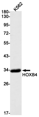 2 - HOXB4 Rabbit mAb AP75568