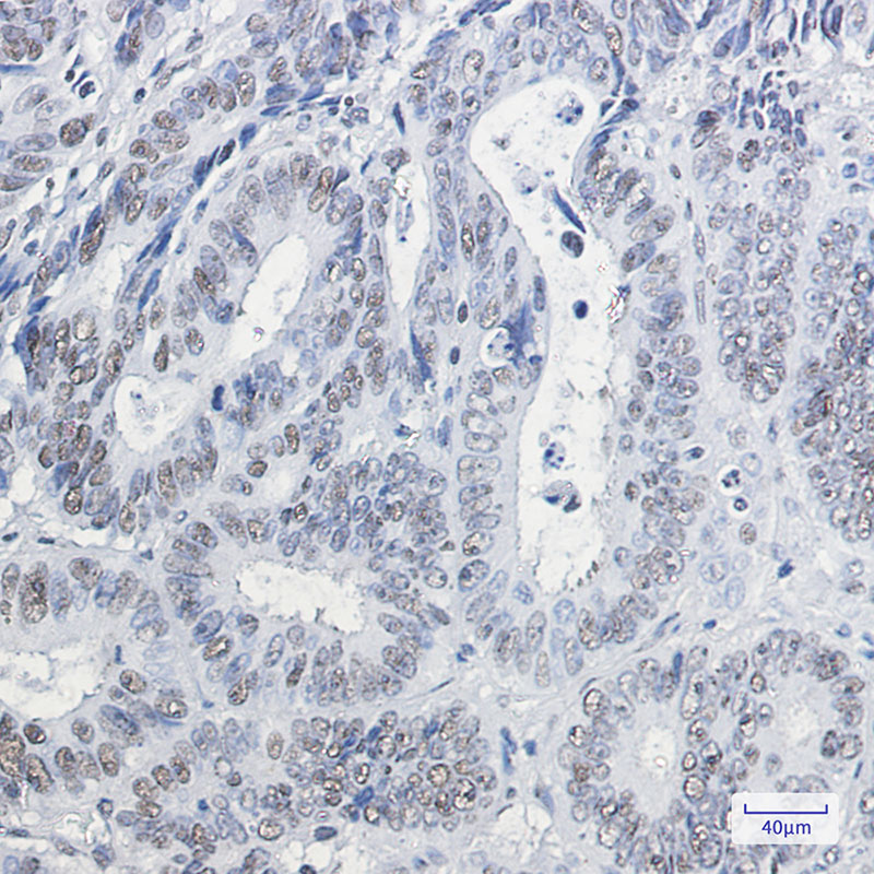 2 - HP1 gamma Rabbit mAb AP75570