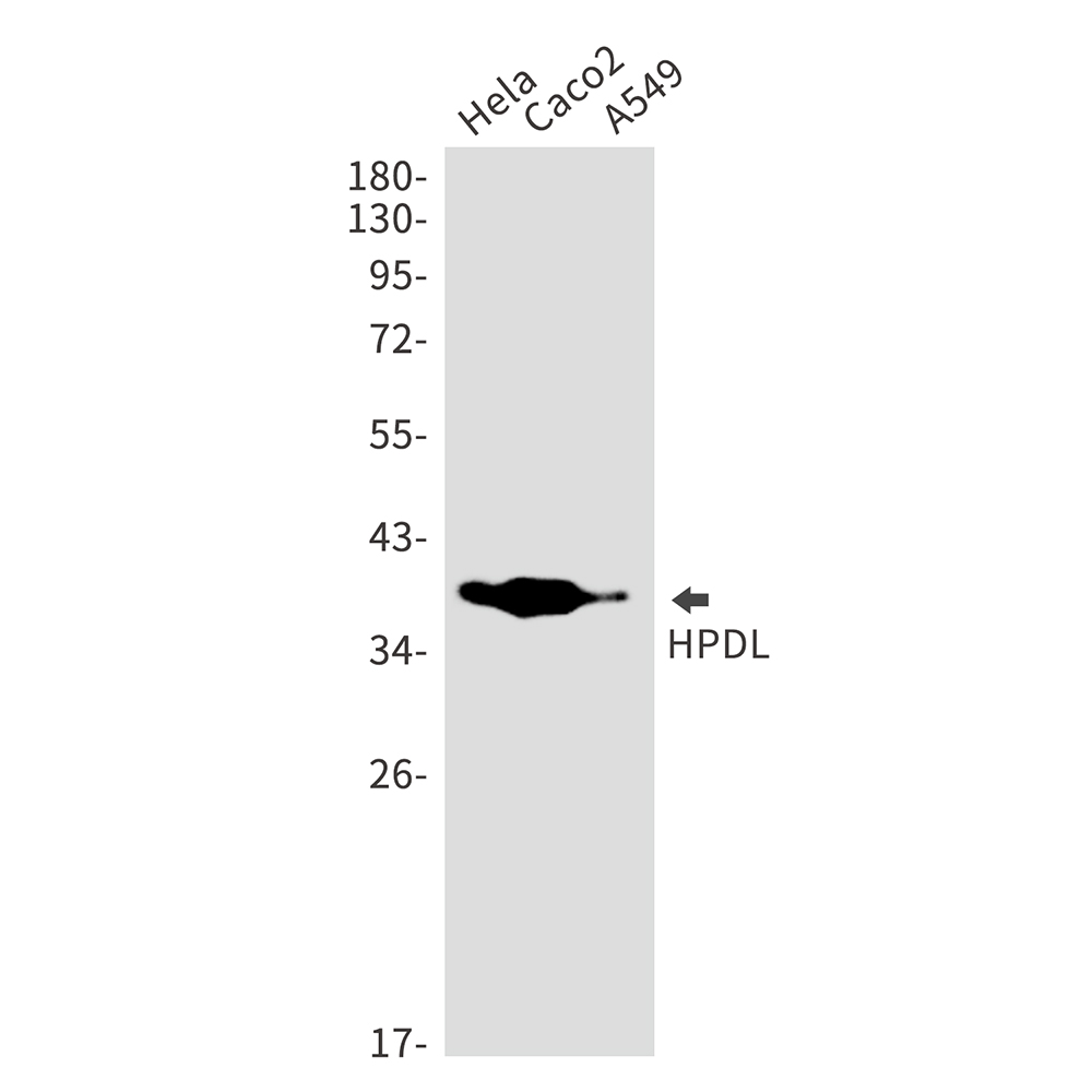 1 - HPDL Rabbit mAb AP75572