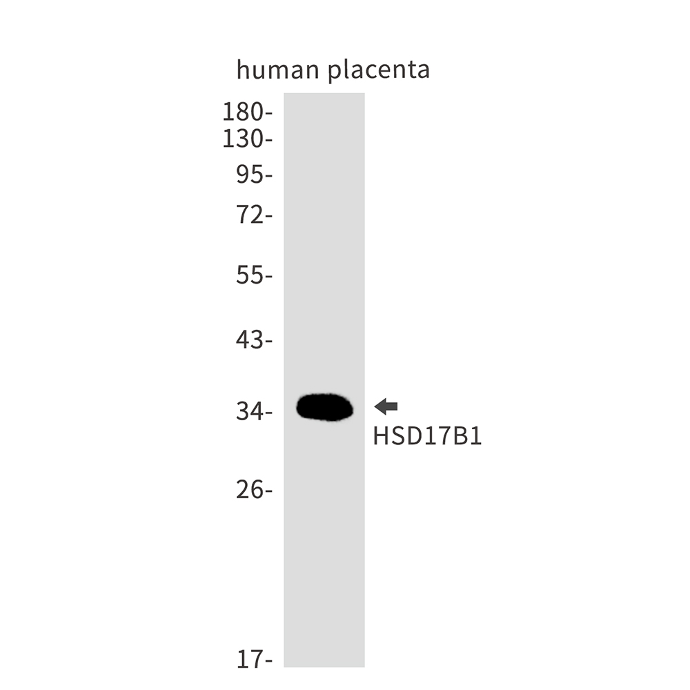 1 - HSD17B1 Rabbit mAb AP75576
