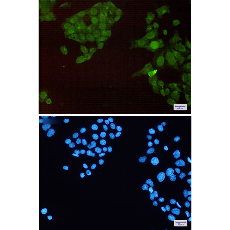 3 - [KO]Phospho-HSF1 (Ser326) Rabbit mAb AP75577