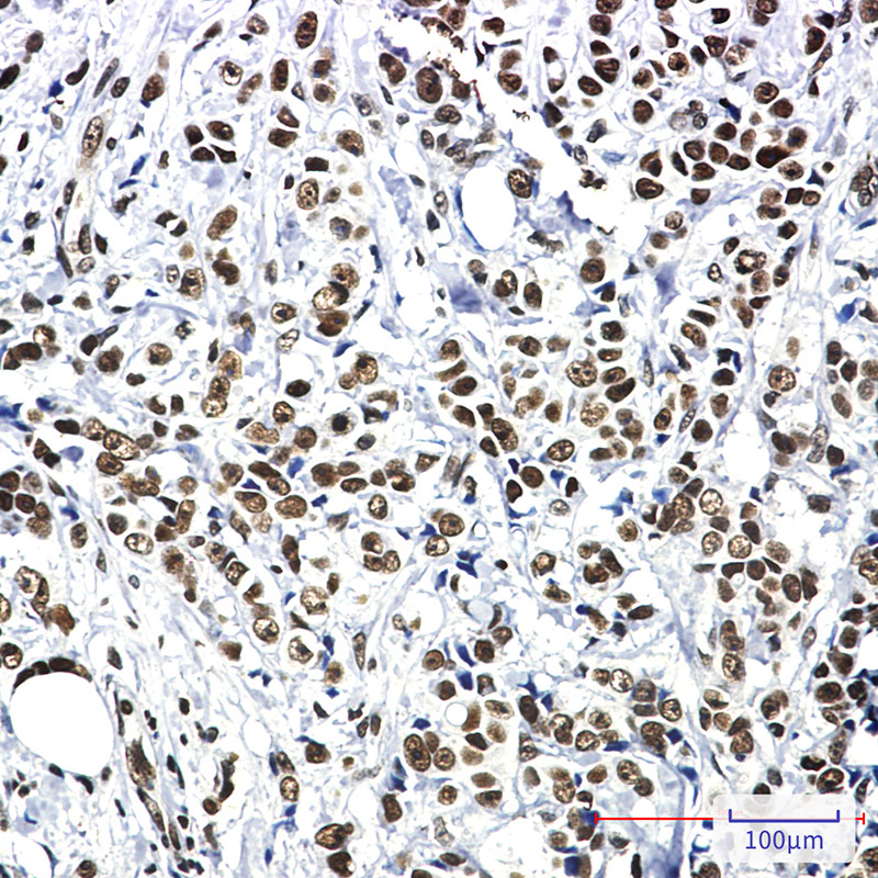 8 - [KO]HSF1 Rabbit mAb AP75578