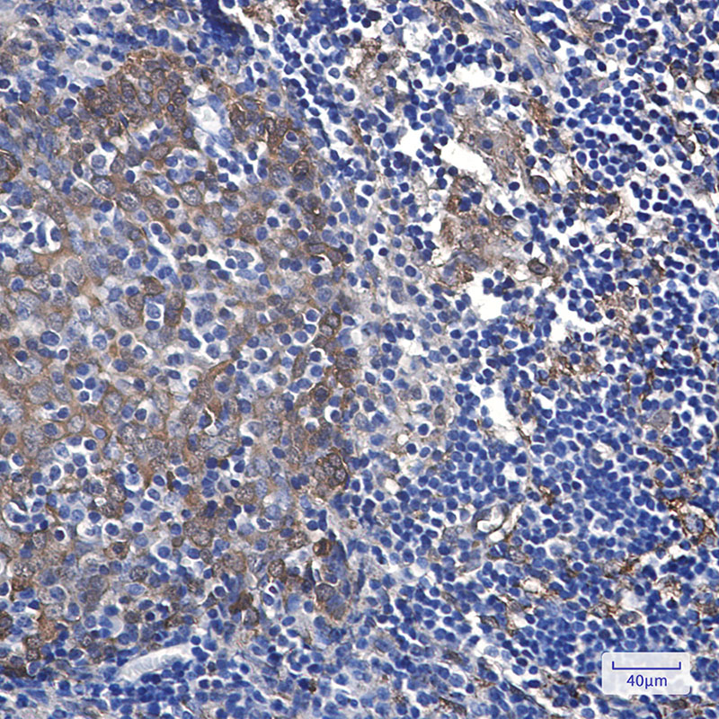 4 - Hsp27 Rabbit mAb AP75580