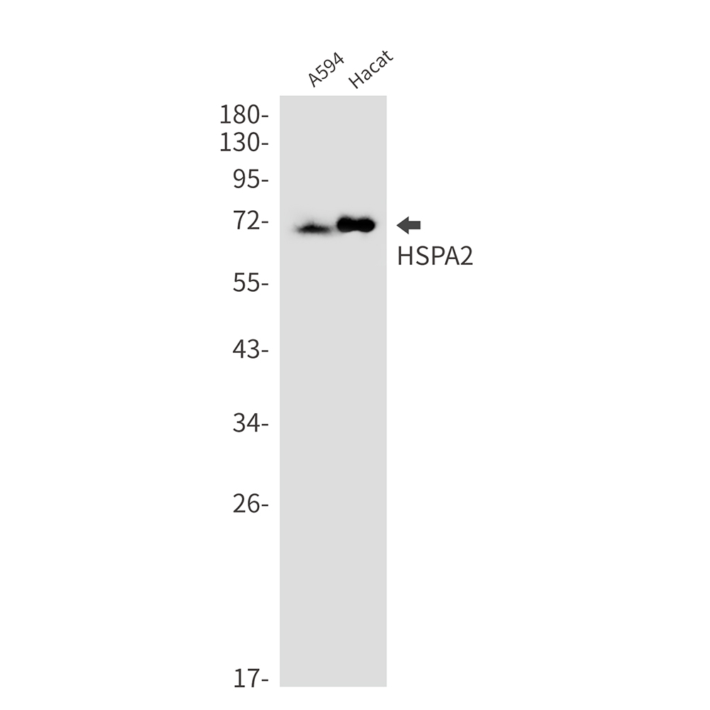 1 - [KO]HspA2 Rabbit mAb AP75586