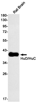 1 - HuC/HuD Rabbit mAb AP75588