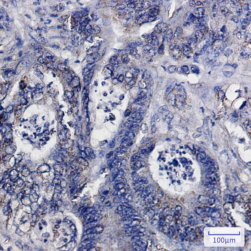 4 - IDH2 Rabbit mAb AP75593