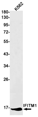 2 - IFITM1 Rabbit mAb AP75594