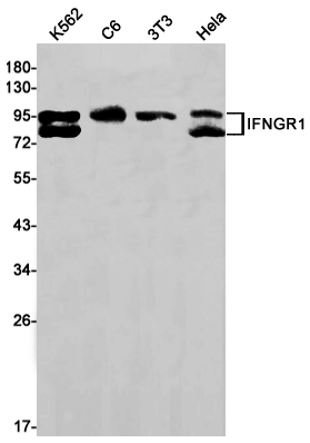 1 - [KD]IFNGR1 Rabbit mAb AP75595