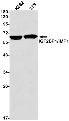 2 - IGF2BP1 Rabbit mAb AP75597
