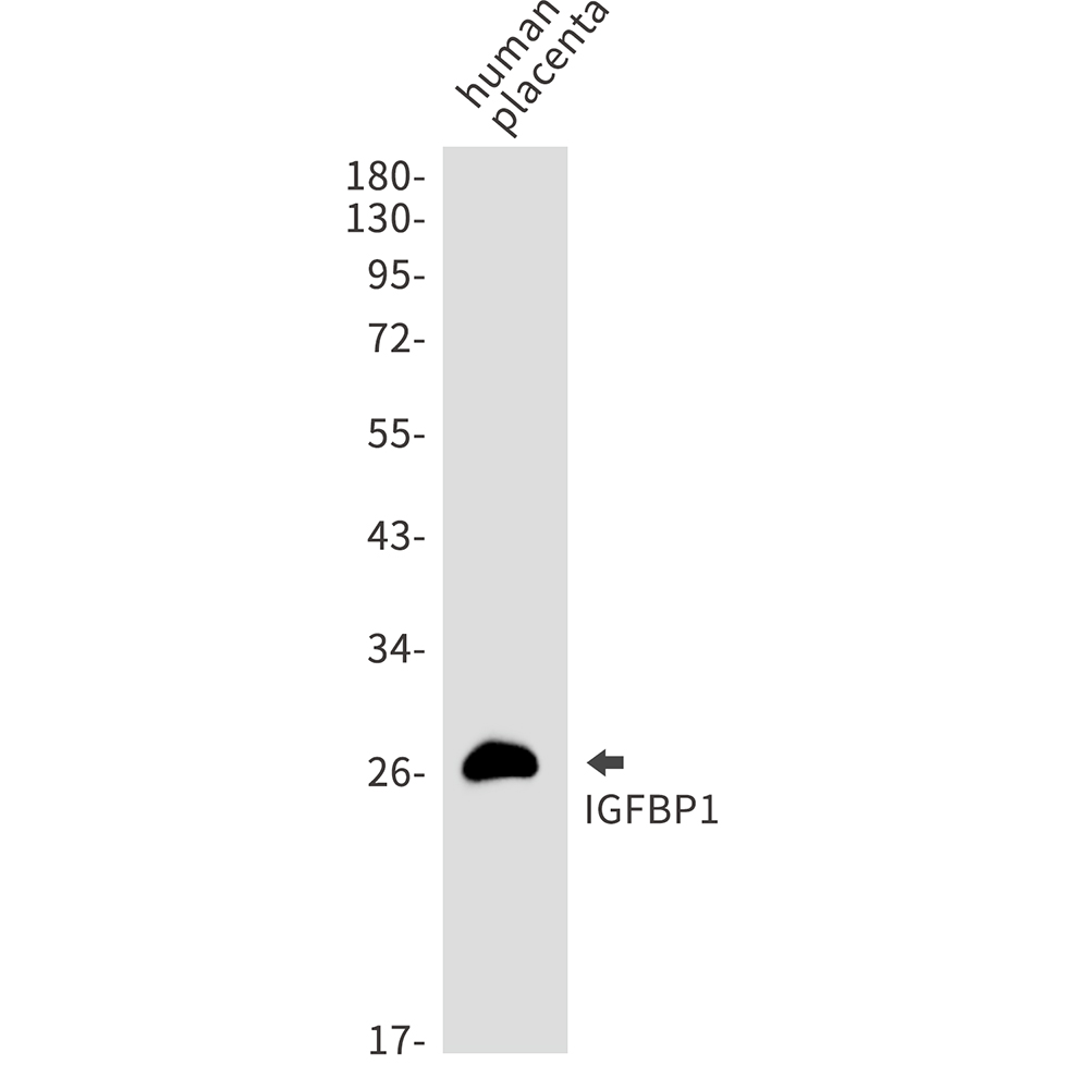 1 - IGFBP1 Rabbit mAb AP75598