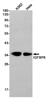 1 - IGFBP6 Rabbit mAb AP75600