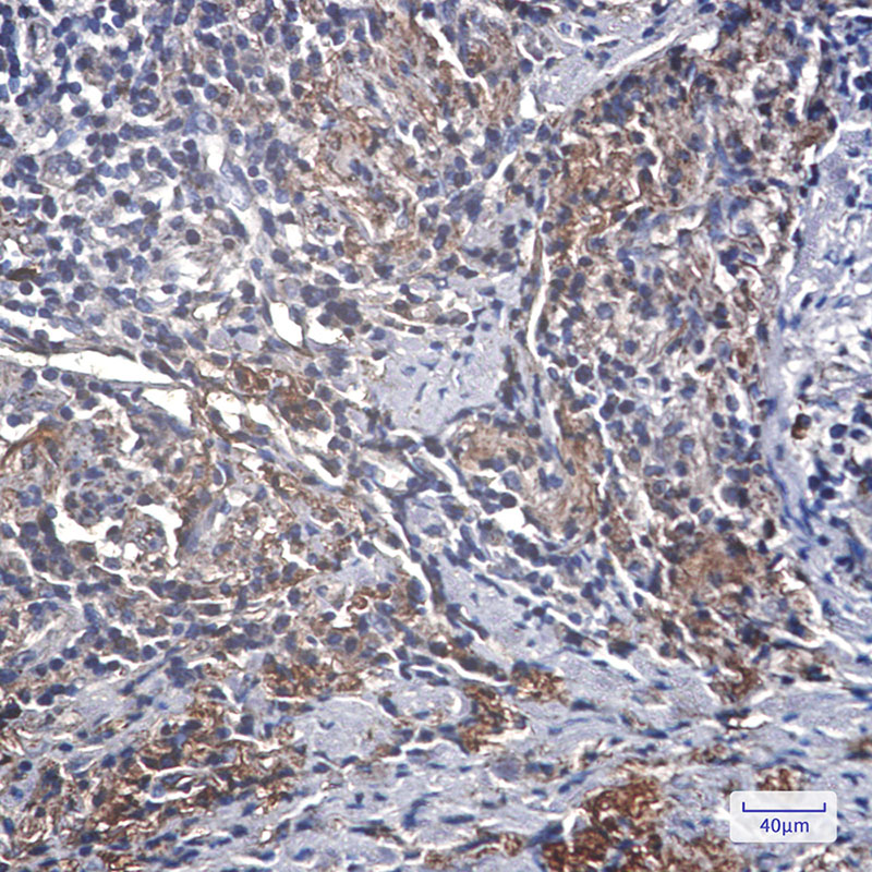 3 - [KD]IGFBP7 Rabbit mAb AP75601