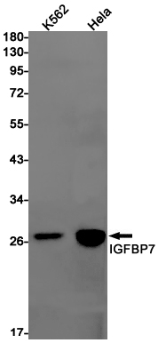 2 - [KD]IGFBP7 Rabbit mAb AP75601