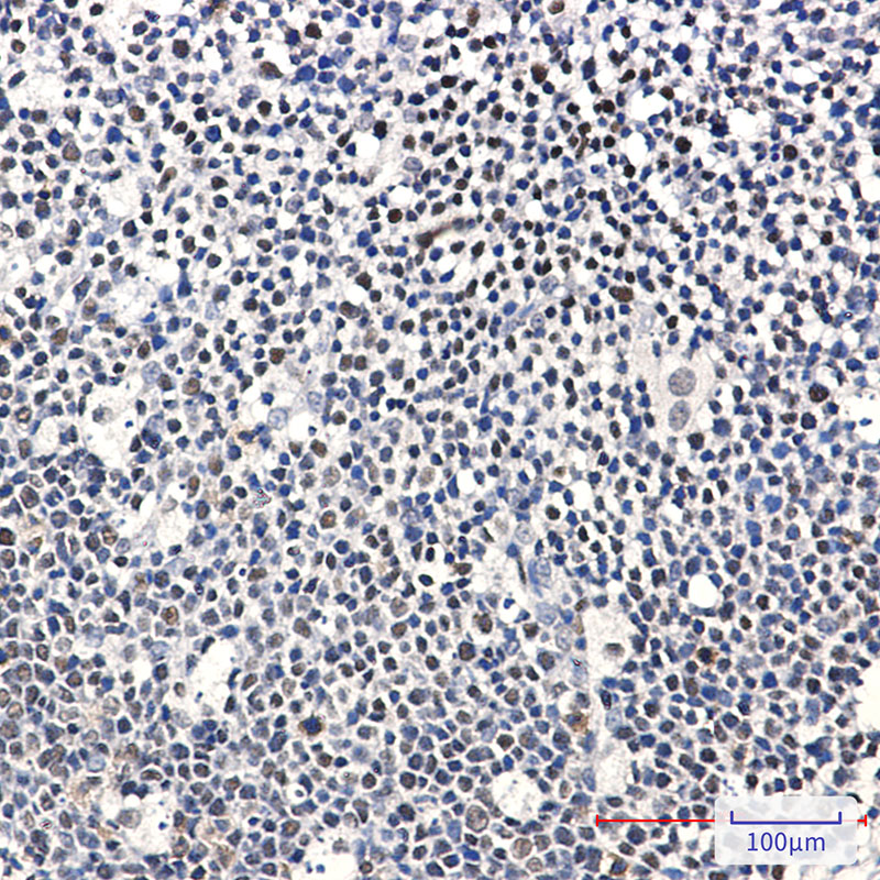 2 - Ikaros Rabbit mAb AP75602