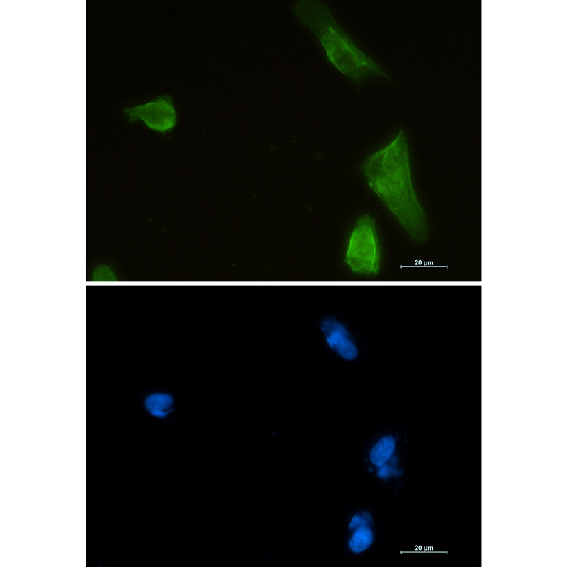 1 - IKK beta Rabbit mAb AP75607