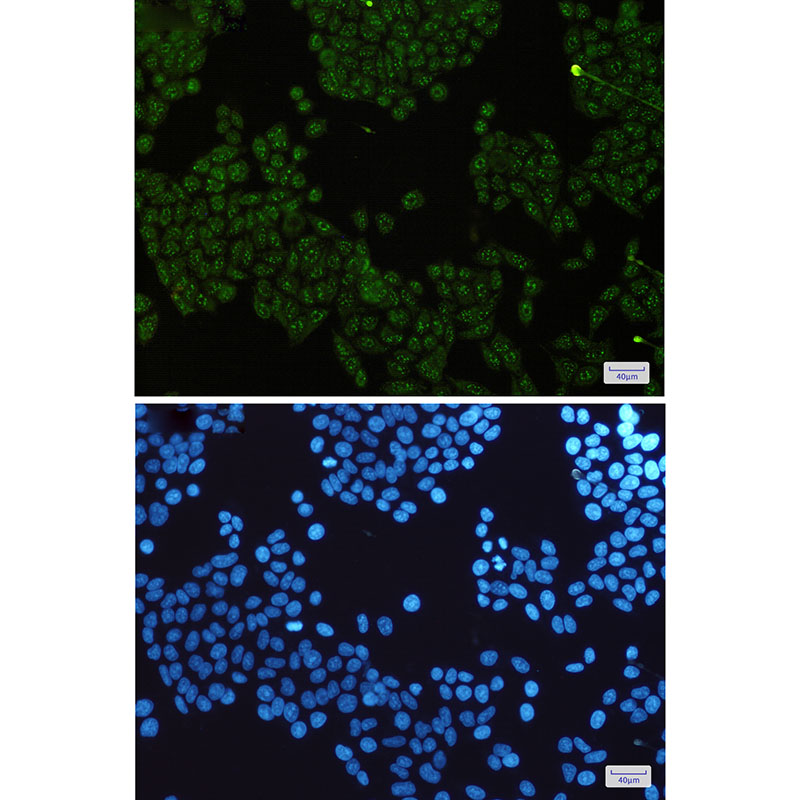 8 - IKK gamma Rabbit mAb AP75609
