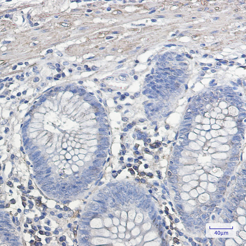 2 - IL-11RA Rabbit mAb AP75610