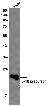 1 - IL-18 Rabbit mAb AP75611