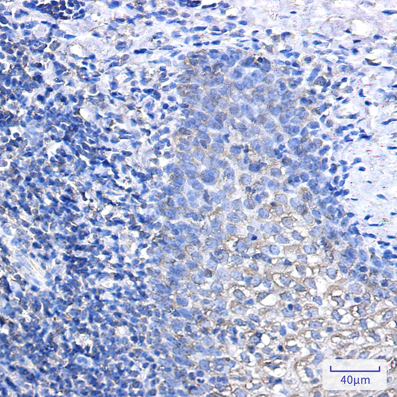 8 - IL-1RA Protein Rabbit mAb AP75612