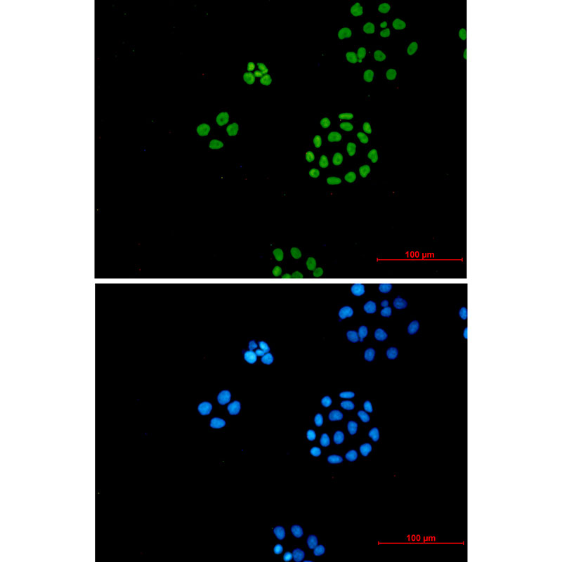8 - ILF3 Rabbit mAb AP75614