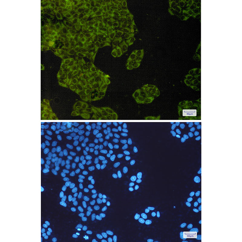 8 - IMP3 Rabbit mAb AP75615