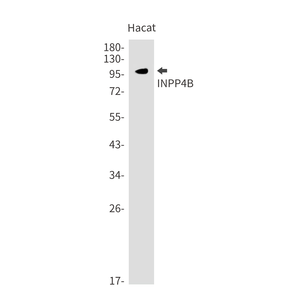1 - INPP4B Rabbit mAb AP75621