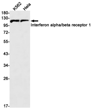 1 - Interferon alpha/beta Receptor 1 Rabbit mAb AP75627