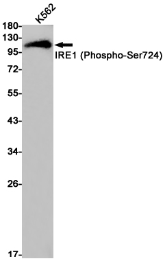 1 - Phospho-IRE1 (Ser724) Rabbit mAb AP75630