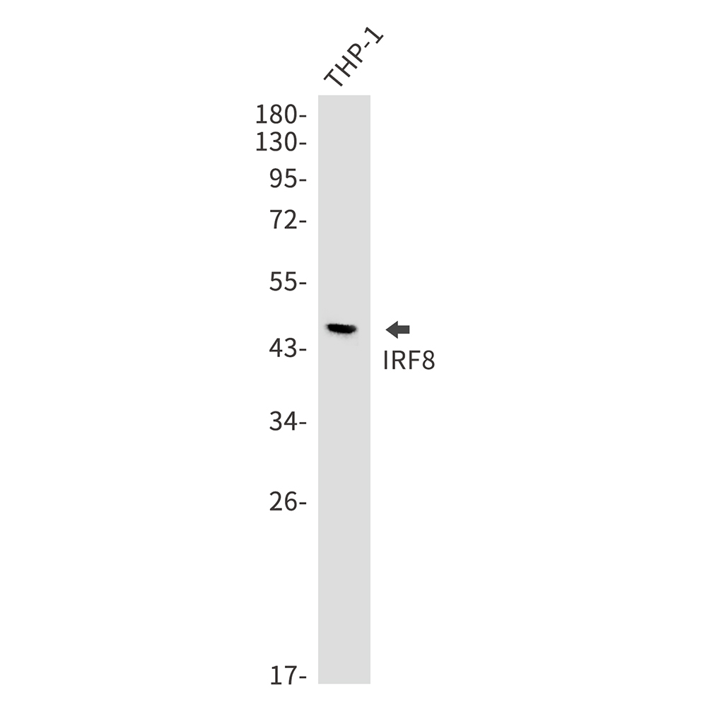 1 - IRF8 Rabbit mAb AP75632
