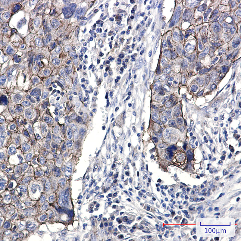 2 - Junctional Adhesion Molecule 1/JAM-A Rabbit mAb AP75641