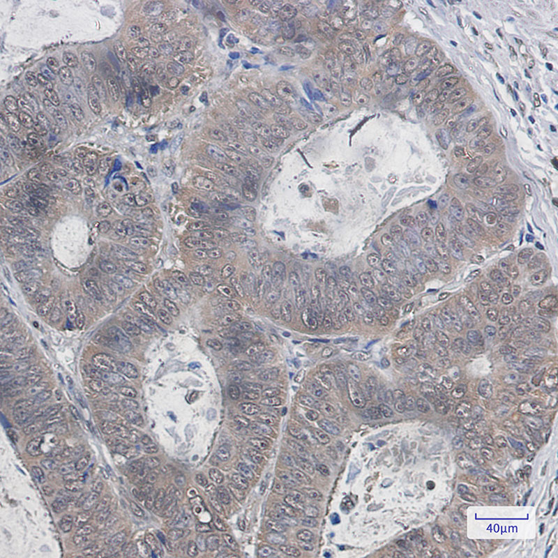 8 - Ubiquitin K48 Rabbit mAb AP75642