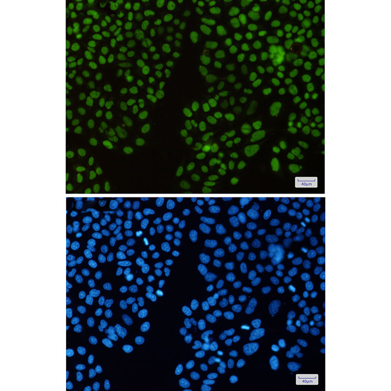 2 - KAT1 Rabbit mAb AP75646