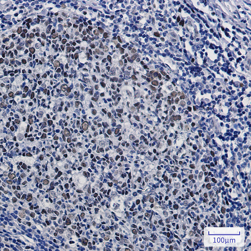 8 - KAT1 Rabbit mAb AP75646