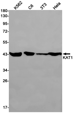 1 - KAT1 Rabbit mAb AP75646