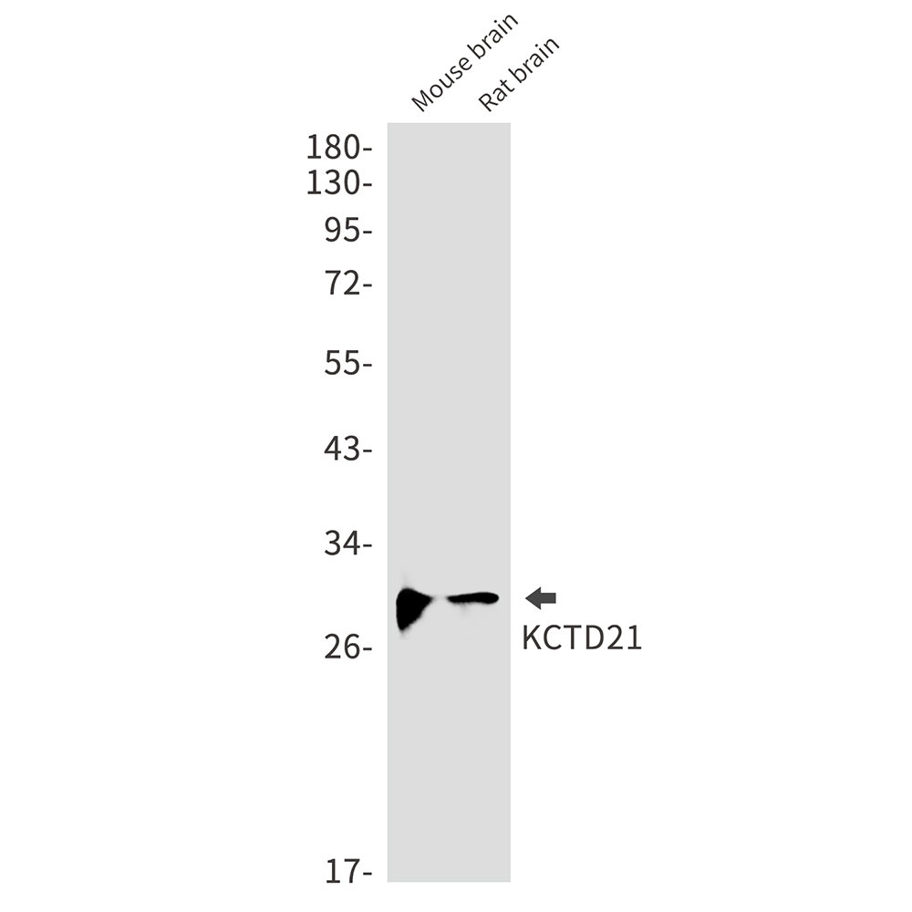 1 - KCTD21 Rabbit mAb AP75647