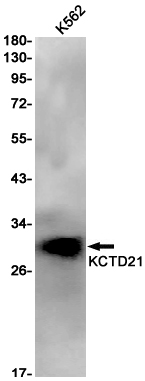 4 - KCTD21 Rabbit mAb AP75647