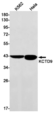 1 - KCTD9 Rabbit mAb AP75649