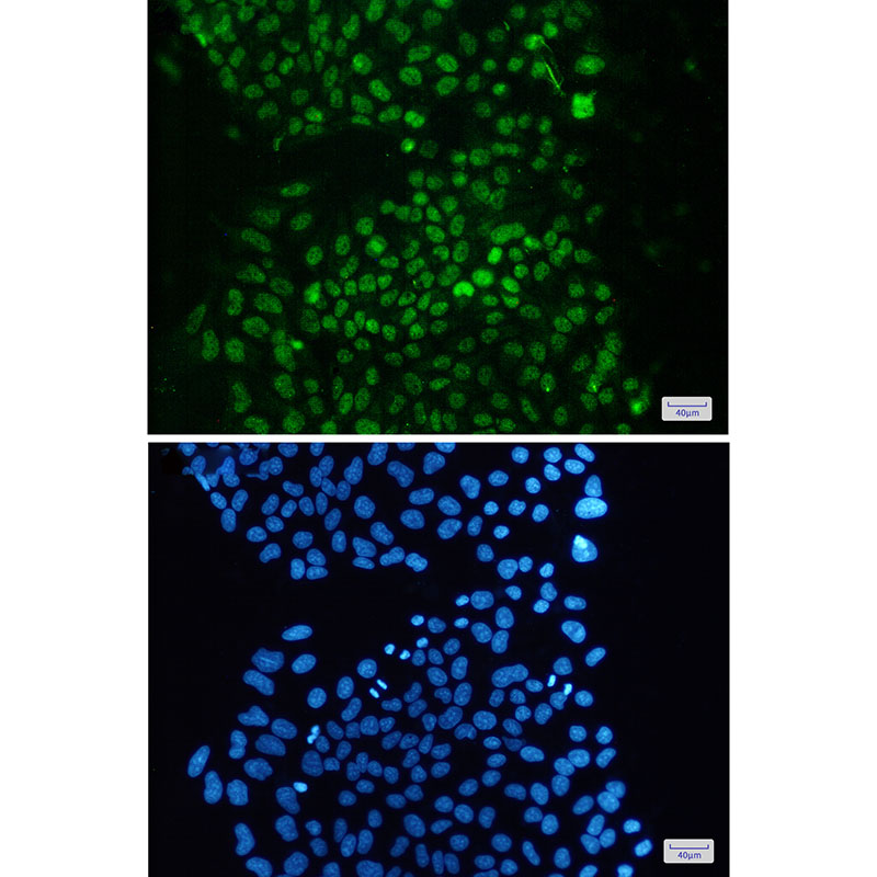 4 - KDM1/LSD1 Rabbit mAb AP75650